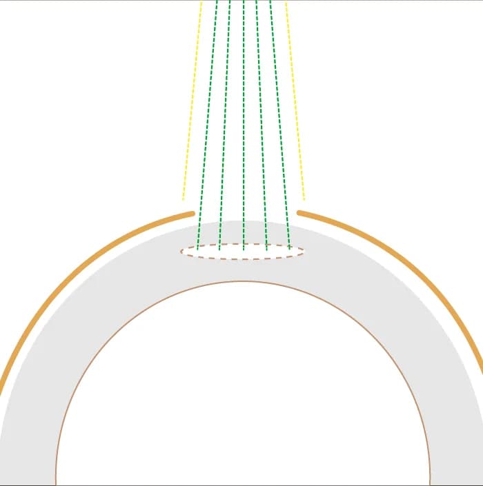 lasik2 2 v